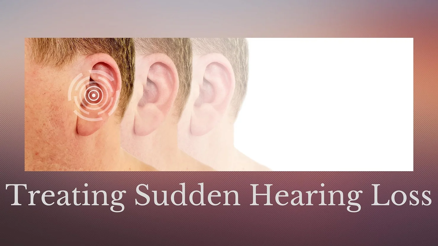 Featured image for “Treating Sudden Hearing Loss”